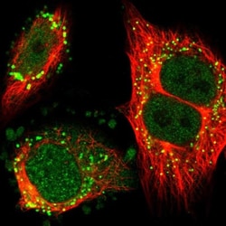ZNF614 Antibody, Novus Biologicals:Antibodies:Primary Antibodies